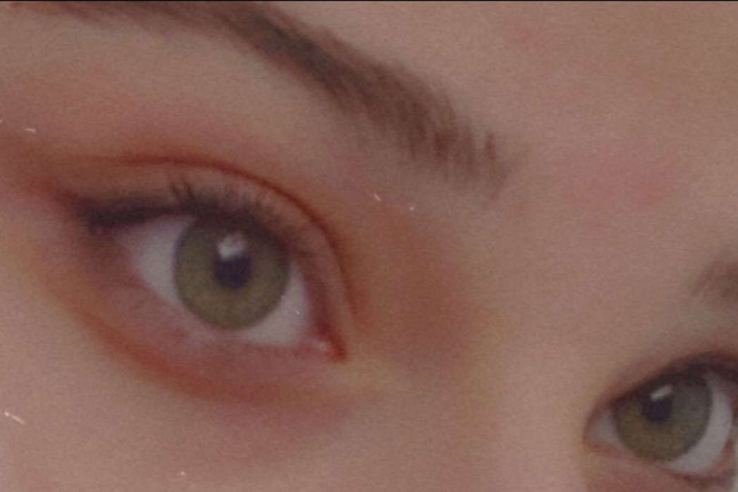 Sema'm,
Benim haylaz arkadaşlarım
yat gezisin de beni denize attı, ani olduğu için nefes kontrolü yapamadım.
Gözüm bu hale geldi.
Dr gittim retina da yırtılma olmuş.Lazerle yapıştıracaklar
AB nin yaptığı araştırmanın çevirisi yapınca sana DM den gönderirim 
Güzel akşamlar olsun