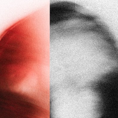 blcklstdpthy's tweet image. my favourite flavour of photos atm