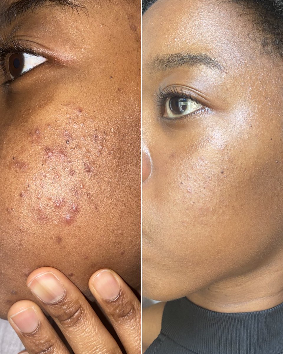 Dermatica tweet media