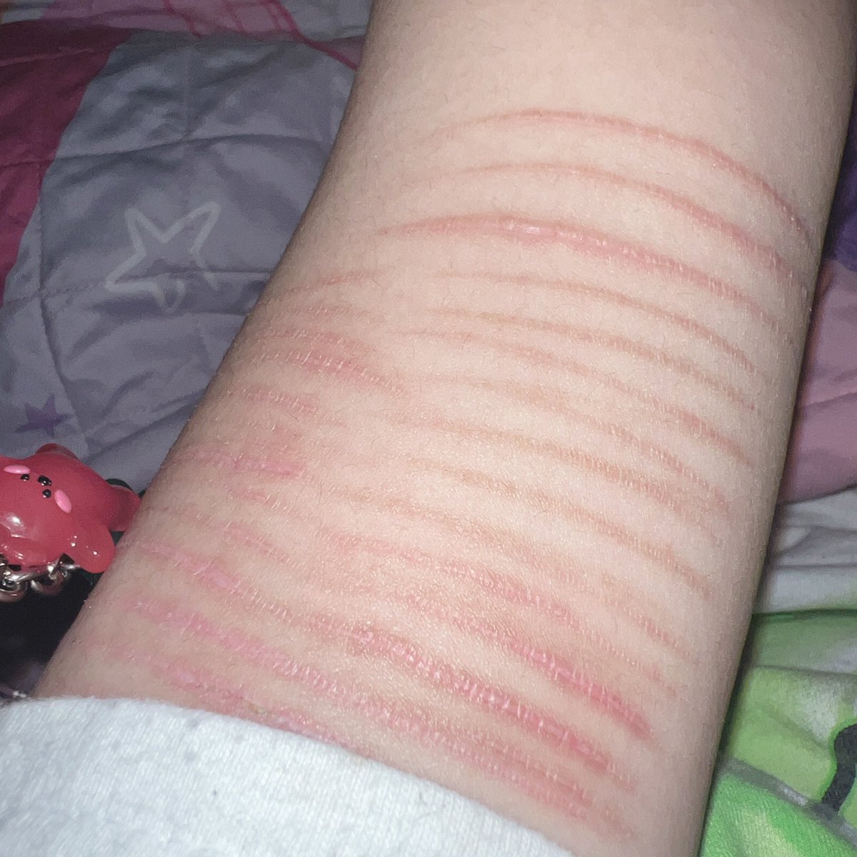 boypussydevil's tweet image. i think my scars are pretty.