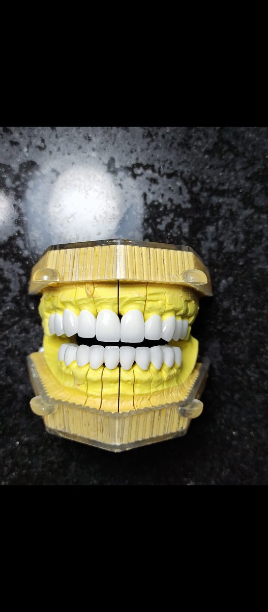 SunSmile_Lab's tweet image. Răng sứ thẩm mỹ chính hãng 🔥🔥