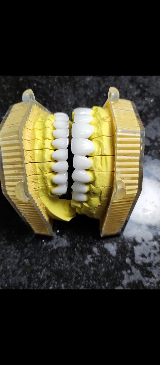 SunSmile_Lab's tweet image. Răng sứ thẩm mỹ chính hãng 🔥🔥