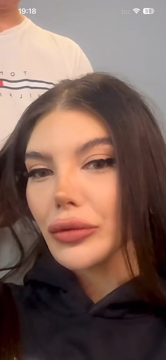 Herkes Belis’e yaptığı hareketi konuşuyor ama kaçırdığınız bir şey var. Evet yanlış hareket. 

Fakat Belis’in cümleleri de Barış’ın onurunu zedeler şekilde. Sürekli pasifsin, okey, banane demesi çok tetikleyici. İletişim yok.

🚩Bunlardan kısmetse de olmaz yaaa 

#kısmetseolur