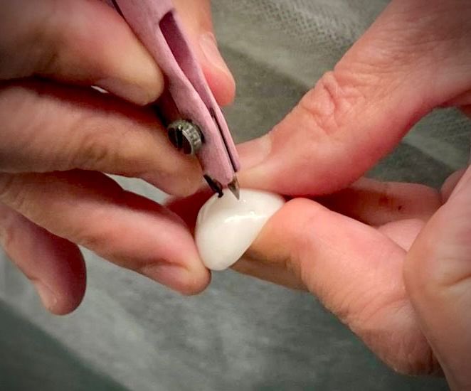 difhgo's tweet image. Esta mañana dio inicio la jornada gratuita de Prótesis Oculares DIFH – CEUMH – UNAM. ✅🫱🏻‍🫲🏼👁️

A lo largo de tres días, esta acción conjunta buscará beneficiar a 100 personas de 28 municipios y 3 Centros de Reinserción Social con prótesis oculares.