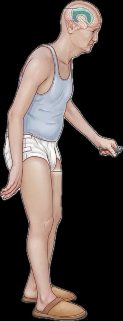 Oren Gottfried, MD tweet media