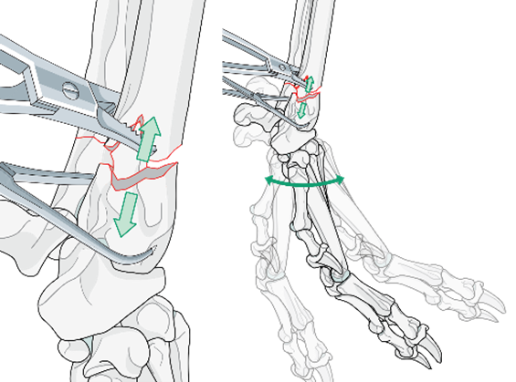 AO Surgery Reference tweet media