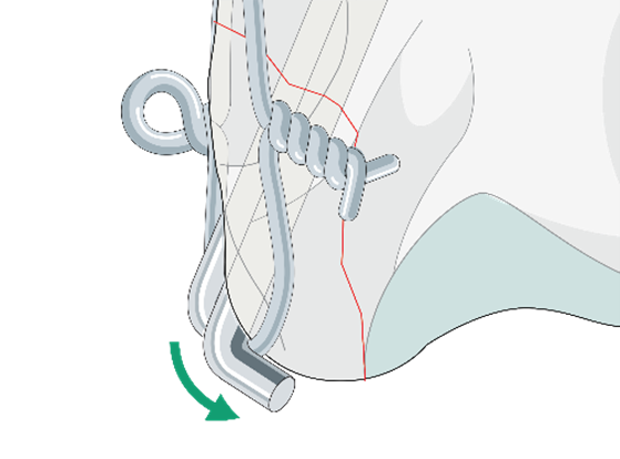 AO Surgery Reference tweet media