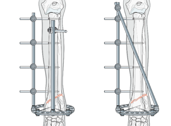 AO Surgery Reference tweet media
