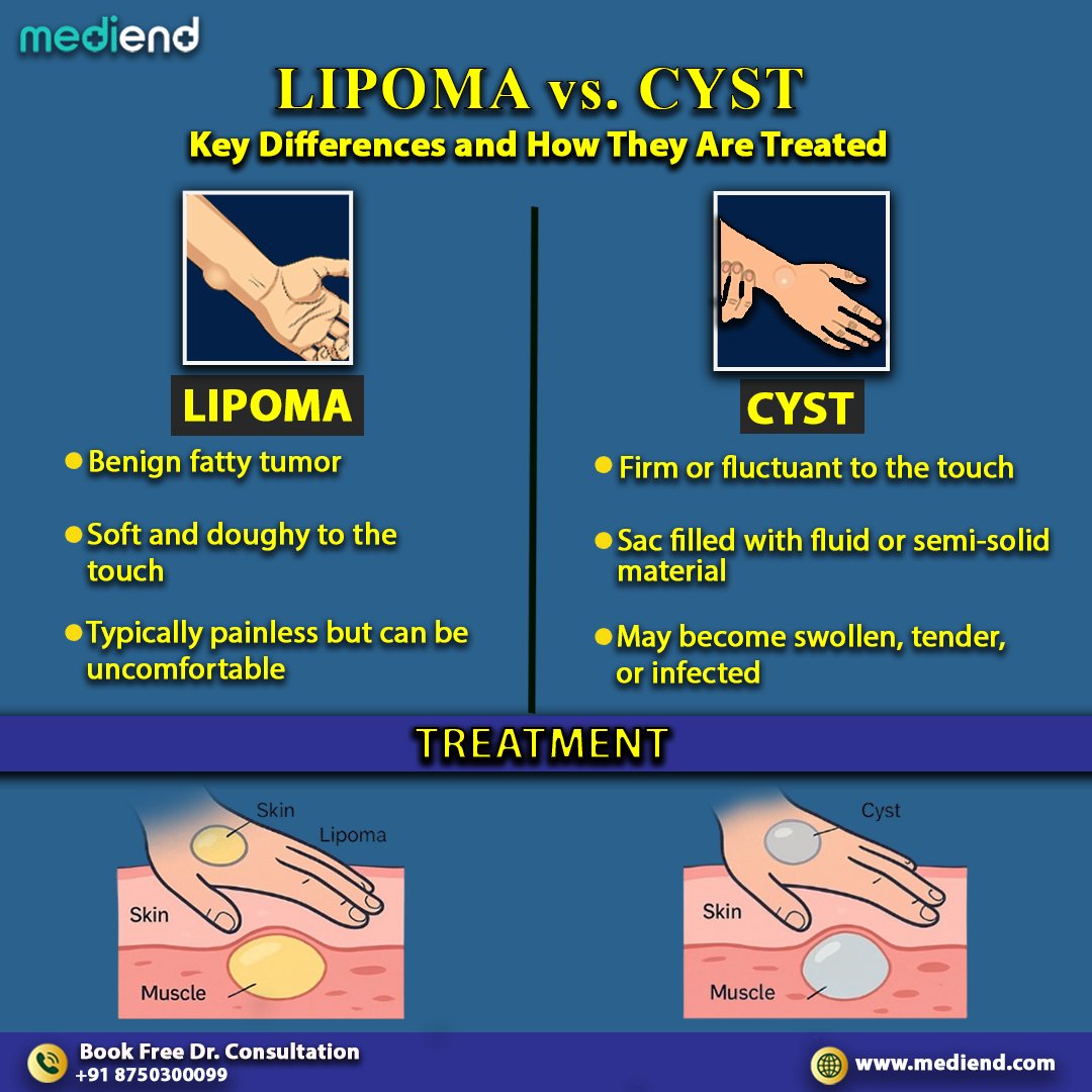 medi_end_'s tweet photo. #Lipoma or #Cyst? Know the difference! 👇
Lipoma: Soft, fatty, painless Cyst: Firm, fluid-filled, may get infected
Both treatable with expert care.
📞 FREE consultation:
+91 8750300099
🌐 https://t.co/y7V25MfdmS
#mediEND #CystSurgery #LipomaTreatment #LipomaVsCyst #CystRemoval https://t.co/kh9mu1BDer