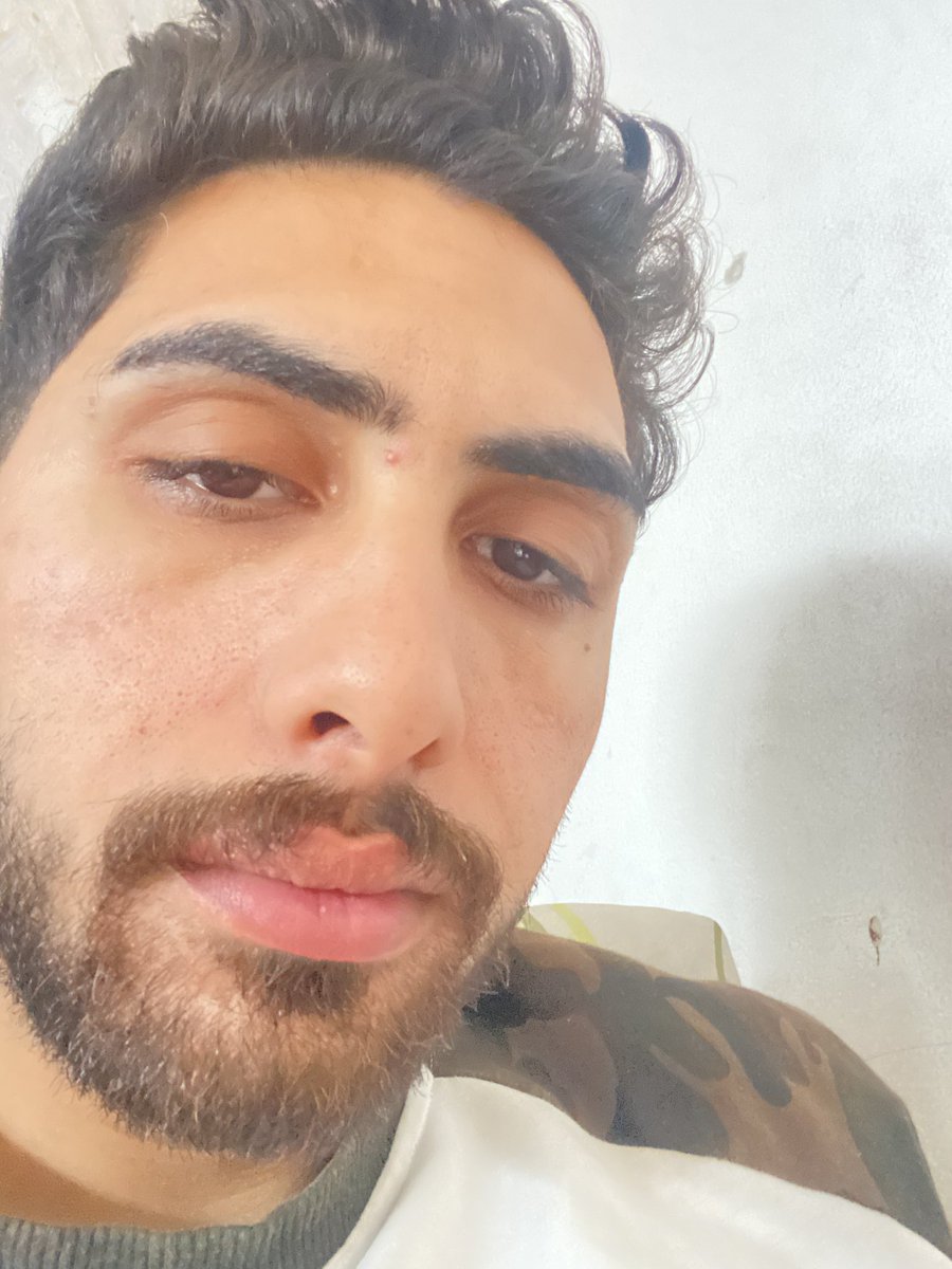 Dr_SaebGaza's tweet image. Unfortunately, I will die 💔

telling you with a broken heart. I have been diagnosed with malnutrition due to lack of food. My body is gradually collapsing. Yes, I am hungry and I cannot buy food😭

 Make me feel you're by my side and leave a period. 

gofund.me/e3ae5efb