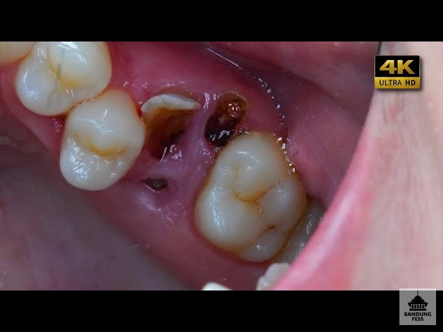 BANDUNG FESS | Kirim menfess cek 📌 tweet media