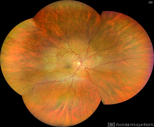 Dr Gunjan Deshpande MRCSEd, FICO (UK), FAICO, DNB tweet media