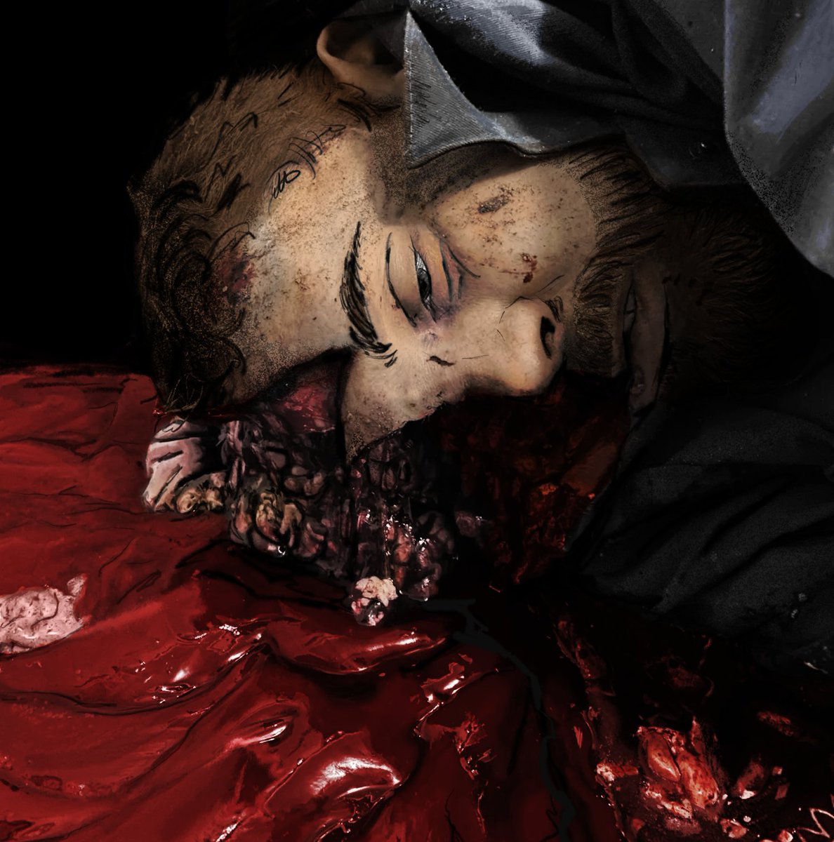 OC
Don’t forget your helmet! Accidents don’t warn you — they just happen! ☺️

CW GORE: Brain, blood, cracked skull.