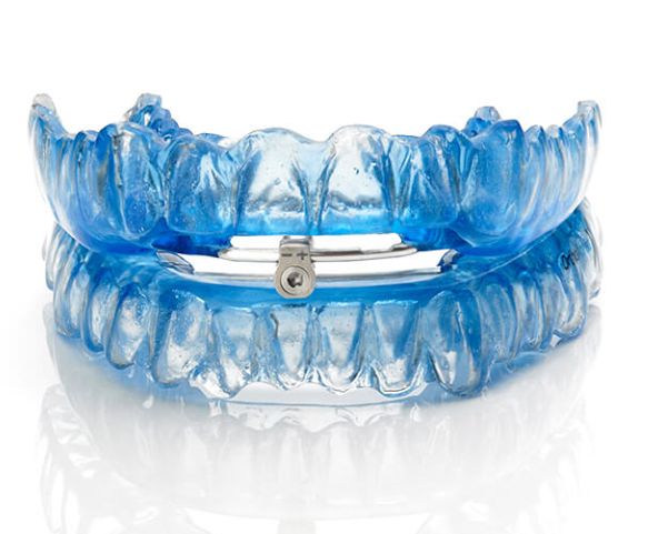 ¿#Sabes qué es un dispositivo de avance mandibular? Estos dispositivos colocados durante la noche pueden solucionar problemas de ronquido o #Apnea leve modificando la posición de la mandíbula. #EscuelaApnea buff.ly/HKvdRkw