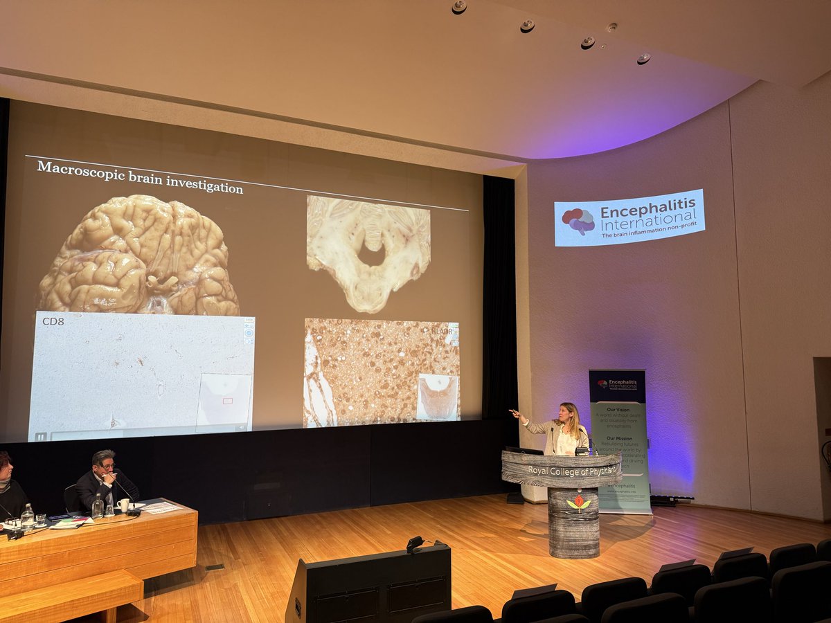 Mayo_AING's tweet image. Prof Romana Hoftberger opening day 2 of #encephalitis #International with her great delineation of pathology of autoimmune encephalitis