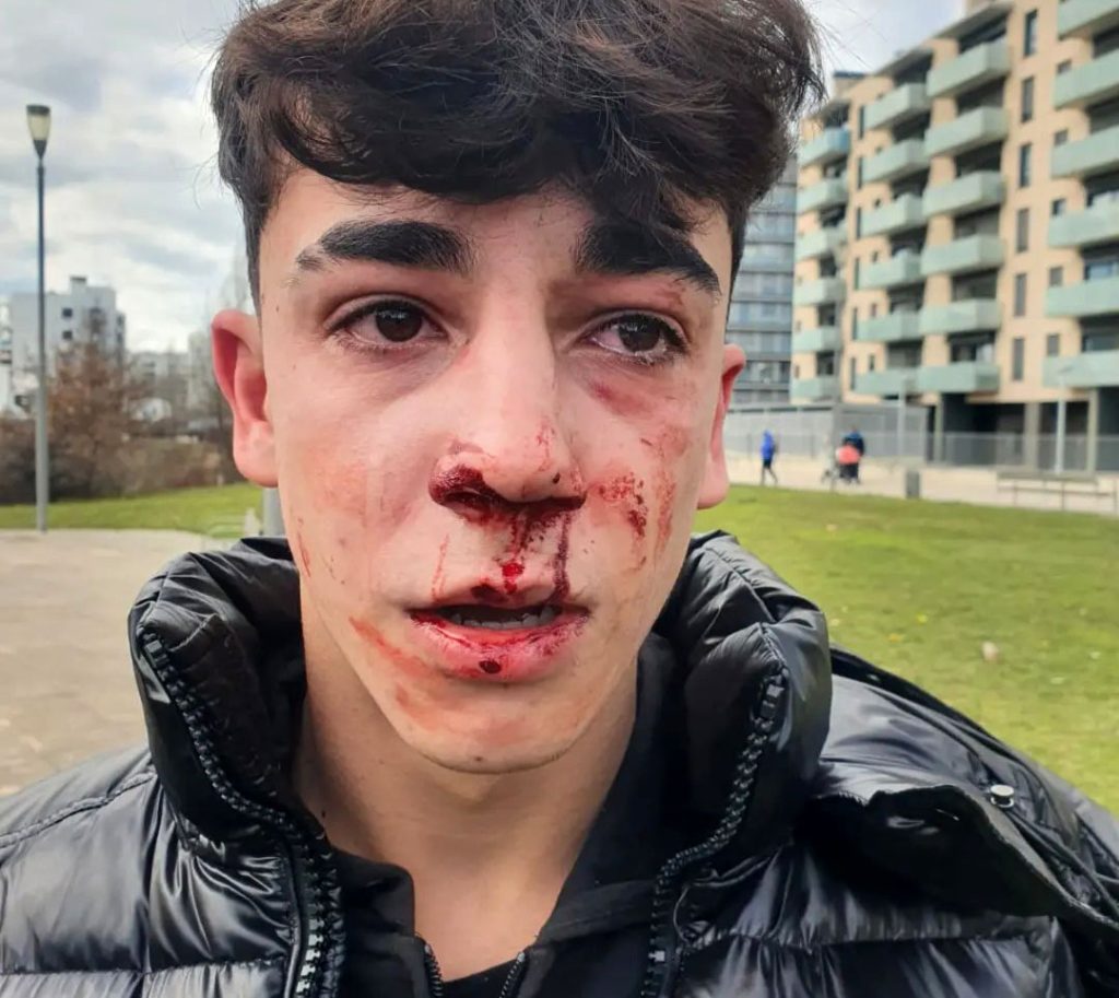 Kartzela eta inhabilitazioa eskatu dute bi udaltzainentzat, gazte bat jipoitzeagatik

labur.eus/uzhwa9w8