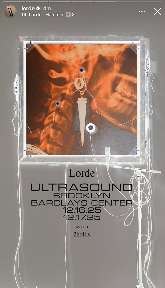 2 months since this post and now 2Hollis is opening for Lorde at the Barclays Center