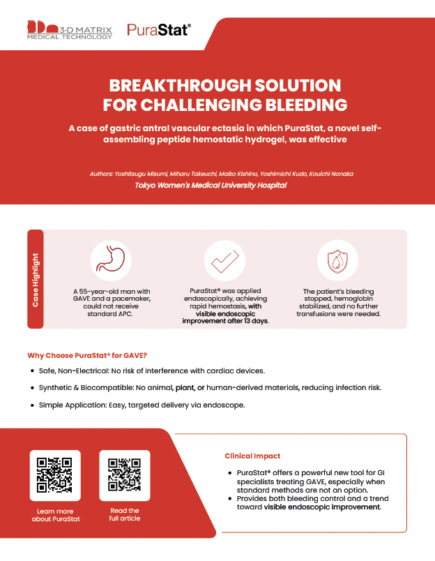 A patient with GAVE &amp; pacemaker couldn’t receive APC so clinicians used PuraStat, achieving rapid hemostasis and visible healing in 13 days.

Safe 
Synthetic 
Simple

A breakthrough for tough bleeds.

Article: threedmatrix.showpad.com/share/J9yZaC2e… 
#PuraStat #GAVE #Endoscopy #Hemostasis