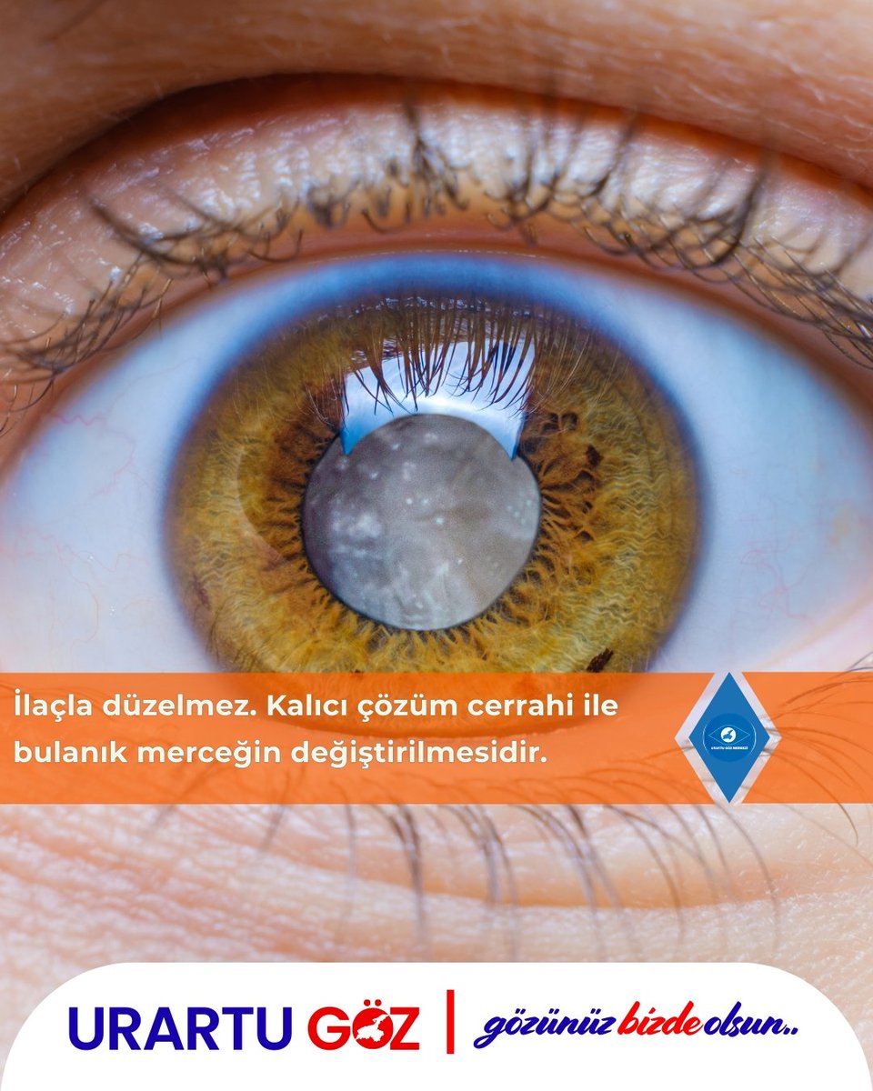 👁️ Katarakt Nedir?

📌 Bu içerik yalnızca bilgilendirme amaçlıdır.
Görme kalitenizde belirgin bir azalma varsa mutlaka göz hastalıkları uzmanına başvurunuz.

📍 Urartu Göz Merkezi

#katarakt #kataraktbelirtileri #gözhastalıkları #gözsağlığı #urartugöz #gözünüzbizdeolsun #bilgi