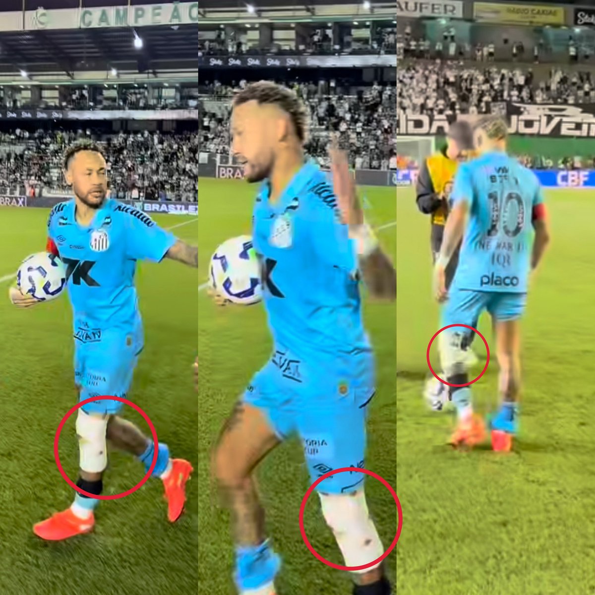 Juezcentral's tweet photo. Miren esa rodilla. El menisco totalmente vendado. 

Es justamente la lesión que tiene Neymar y que los médicos recomiendan operar pronto. Él mismo fue el que dijo que quería jugar lo que queda del torneo para salvar al Santos del descenso.

Y en los últimos 2 partidos, lleva 4 goles y 1 asistencia. Ayer, Hattrick contra Juventude y balón a casa. 

Ney fue al frente cuando más lo necesitaba su equipo del alma. Así de crack es Ney.