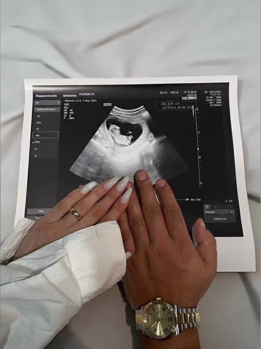 𝑂𝑛𝑒 𝑑𝑎𝑦 ❤️