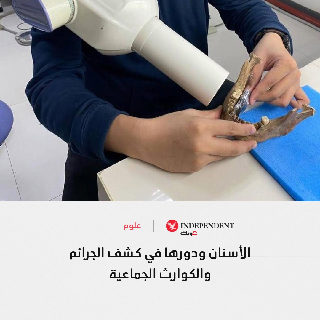 📌تعد الأسنان دليلاً حاسماً في كشف الجرائم وتحديد هوية الضحايا، لقدرتها على الصمود وكشف بصمات العض والسجلات السنية، مما يجعلها أداة موثوقة في التحقيقات والكوارث الجماعية... فلماذا هي تحديداً؟
independentarabia.com/node/637640
#نكمن_في_التفاصيل | <a href="/ghadasaud15/">غاده سعود</a>