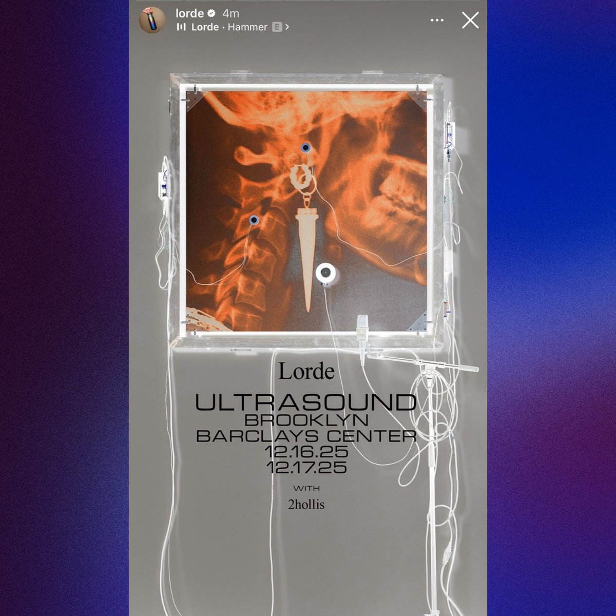 Lorde announces 2hollis will be opening two of her Ultrasound Tour shows in Brooklyn.