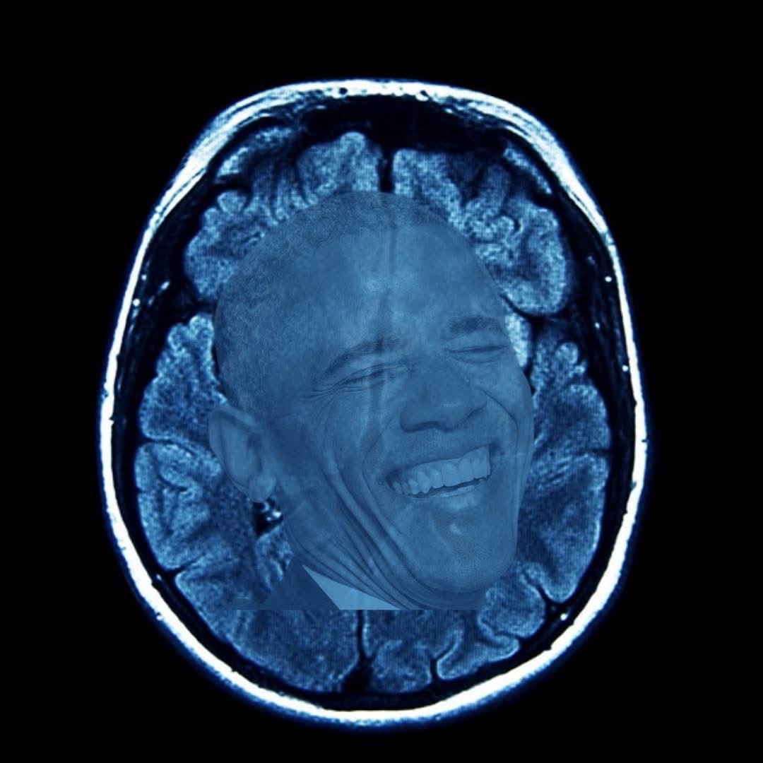 Gavin Newsom posted this - Trump’s MRI results.