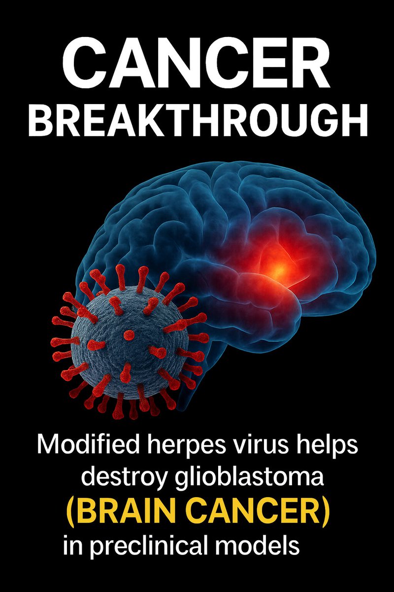Dr_Singularity's tweet photo. Cancer breakthrough

Researchers at Mass General Brigham engineered a precision targeted herpes virus (HSV-1) that hunts down glioblastoma cells and supercharges the immune system to destroy them.

This modified virus can deliver five powerful immunotherapy payloads, reprograms the tumor microenvironment, lights up on PET scans for tracking, and includes built in safety switches to protect healthy brain cells.

In preclinical models, a single dose boosted T-cells, NK cells, and myeloid responses, destroying tumor defenses and significantly extending survival.

Scientists call it a safe, traceable, multipronged oncolytic platform with huge potential for human trials and other hard to treat cancers.