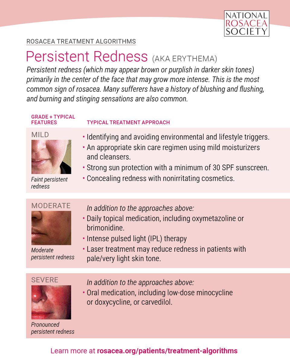 rosaceaorg's tweet photo. This infographic on treatment options for persistent redness (erythema) is part of a series of guides to the recommended approaches for each sign and symptom of rosacea, at every level of severity. See the full treatment algorithms on our website at https://t.co/1zYXdHfNKG https://t.co/8RjjEP8gtn