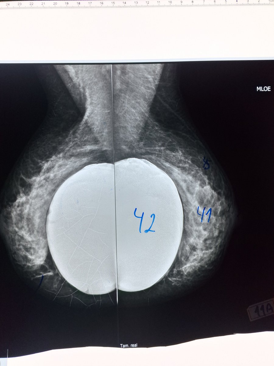 essealisson's tweet image. Essa foto do nada no meu celular da aula. Não lembro que isso, testiculos?