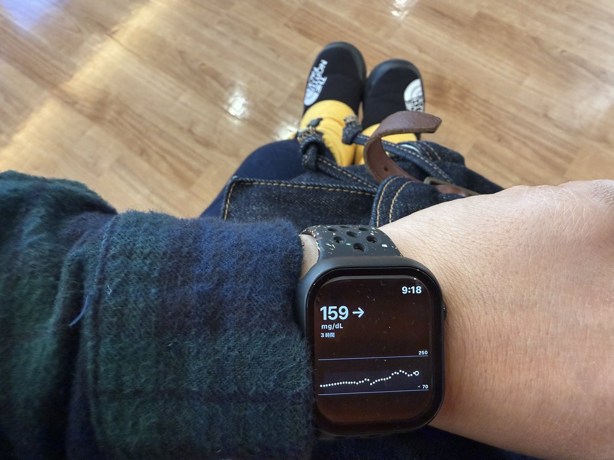 Type1Com's tweet image. おはようございます♪
今日は眼科の半年ぶりの定期検診
顔面麻痺の方は別の大きい病院にかかってるので糖尿病の方の眼科検診💦
目悪くなってた⤵️
動画にしようか迷う…
久しぶりに自分の食生活やら見直してる現在です…血糖値DexcomG7159は食後1時間くらいかな
#糖尿病 #DexcomG7 #おうちごはん