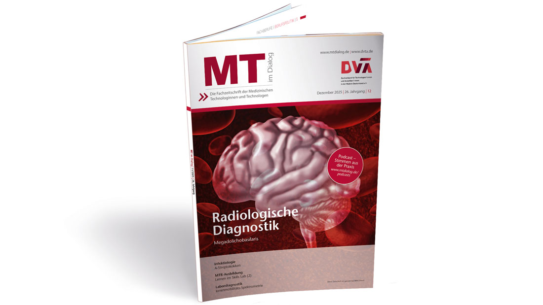Das ePaper der MT im Dialog Ausgabe 12 ist ab sofort abrufbar: mtdialog.de/news-fachbeitr…. Titelthema: Megadolichobasilaris, daneben u.a. noch Beiträge zu simulationsgestütztem Lernen bei MTR, Infektiologie: A-Streptokokken, Labordiagnostik: Ionenmobilitäts-Spektrometrie