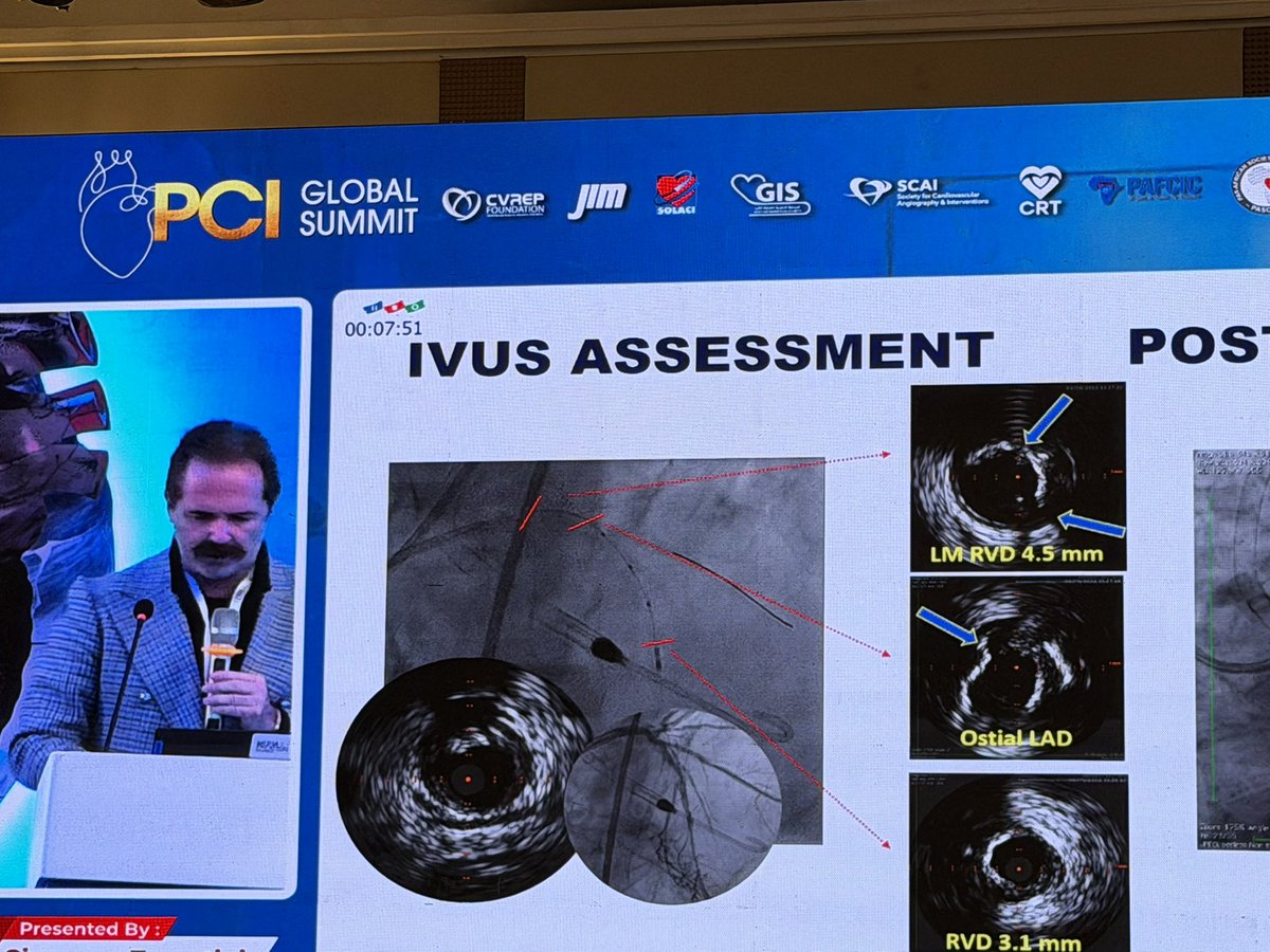 Hragy's tweet photo. @aymanka Cairo’s PCI Global Summit organized by @CVREPfoundation with #JIM #SOLACI. @GisGulf @SCAI #CRT #PAFCIC #PASCAR https://t.co/EXYidOctam