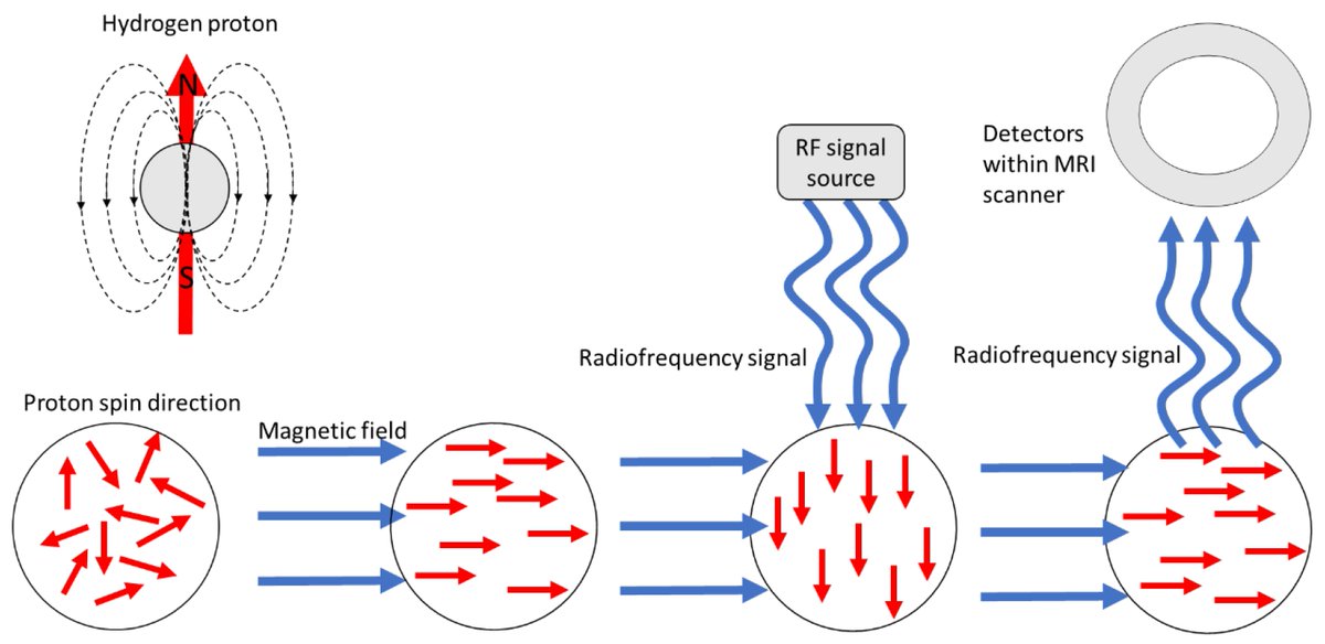 Our most popular paper is here! 👀
The most viewed, downloaded, and cited article in our journal is:
“Use of Superparamagnetic Iron Oxide Nanoparticles (SPIONs)…”
✍️ By Mukesh K. Pandey et al.
Read here 👉 brnw.ch/21wY6F8