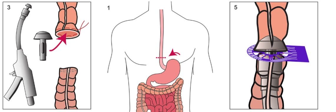 Bioelectronics Drop tweet media