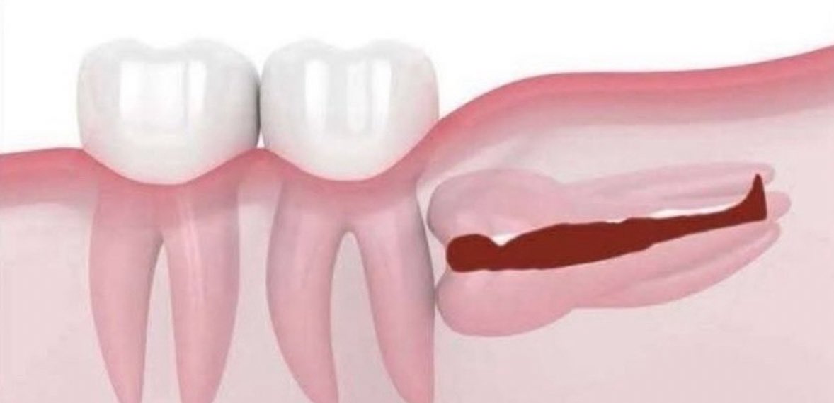 #라테일 #카즈이리
카즈이리 낛 . .
 . . . .
 . .
. .
. .
. .
. .
.