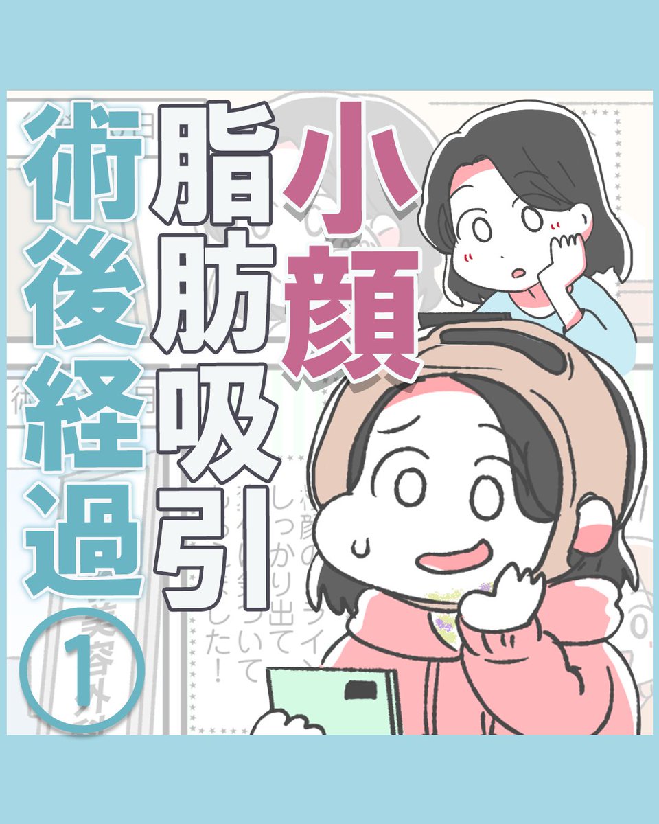 OsakaMiyabi's tweet photo. （1/3）【小顔脂肪吸引のダウンタイム実況中継】
脂肪吸引後1か月間の痛みや内出血、違和感、変化などリアルな経過をご紹介します。
また、フェイスバンドは手術当日以外は外出時に外してもOKです。
#まんがが読めるハッシュタグ https://t.co/Sn5Xx7M1pz