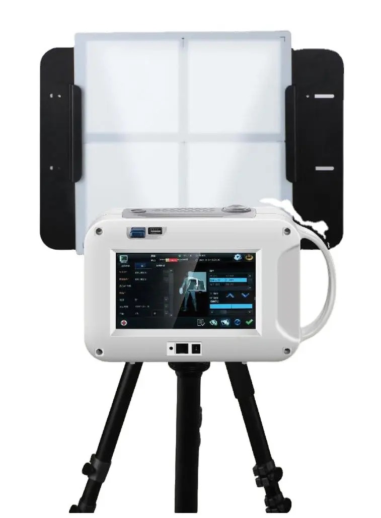 MedtrustTrading's tweet image. Portable handheld X-ray system: 19kg, 150+ exposures/charge, 7" touchscreen, low radiation, and built-in imaging software 🩻⚡ Ideal for clinics, field rescue, and remote care.
Chengdu Jiuxin Xinde Medical Co., Ltd. ✉️ zhanghao@medicaljxxd.com 📱 +86 15881199040
#handheldxray