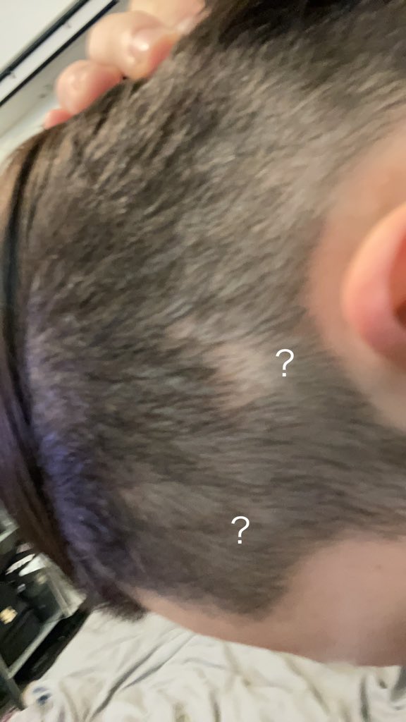 こいつらも小ハゲだったらどうしよう