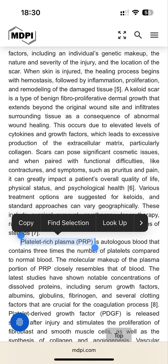 dr_ijzeR's tweet photo. Interesting topic, but the manuscript raises real concerns. Repeated abbreviation definitions even in the conclusion?(AI?) No registration?, high heterogeneity with limited interpretation, and inconsistent methodology reporting. Yet still accepted. How did this pass peer review? https://t.co/q6tEMbDqBH