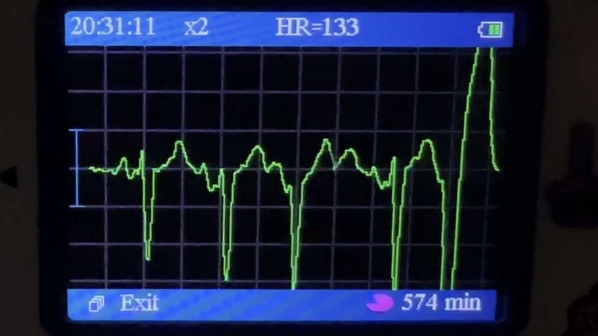 こんな波形の乱れもっと出たら面白いのに