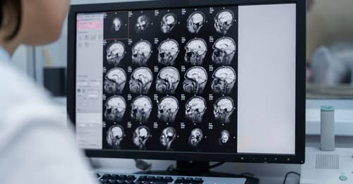 BibliotecaCQ's tweet image. O maior #estudos de #neuroimagem sobre #condicionamento do #medo revelou padrões de ativação cerebral distintos entre indivíduos saudáveis e aqueles com #transtornos de #ansiedade ou #depressão. 
@FCFUSP @iq_usp @usponline @IPqHCFMUSP 
jornal.usp.br/uspnews/brains…