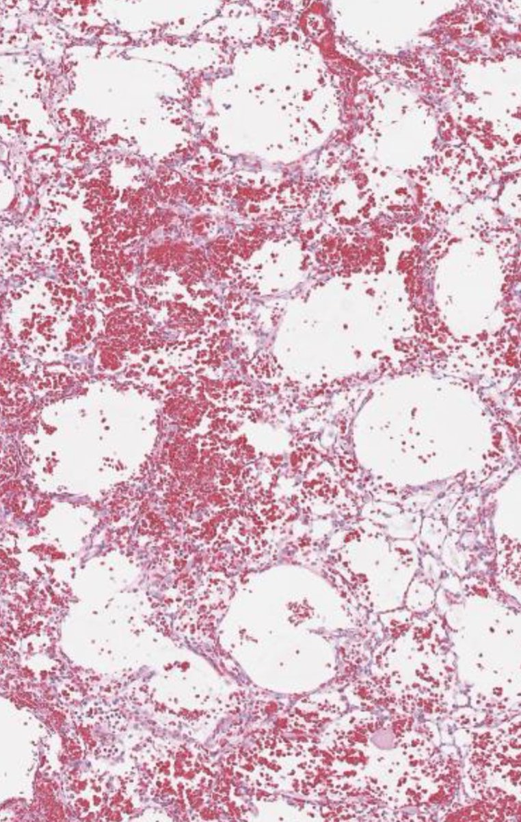 Julie Feldstein,MD tweet media