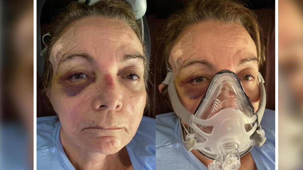 Recuerdo cuantas veces le negaron atención médica a la ex ministra Roca, ella presa durante el gobierno de Luis Arce.
El karma es ese amigo con gran memoria que nunca te deja olvidar las cosas que hiciste a los demás.