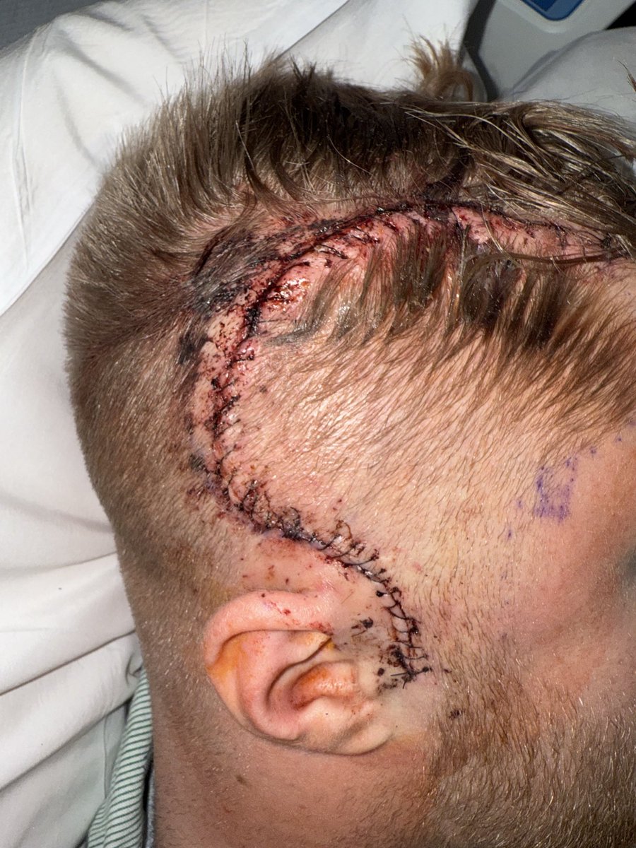 Tristan Jass tweet media