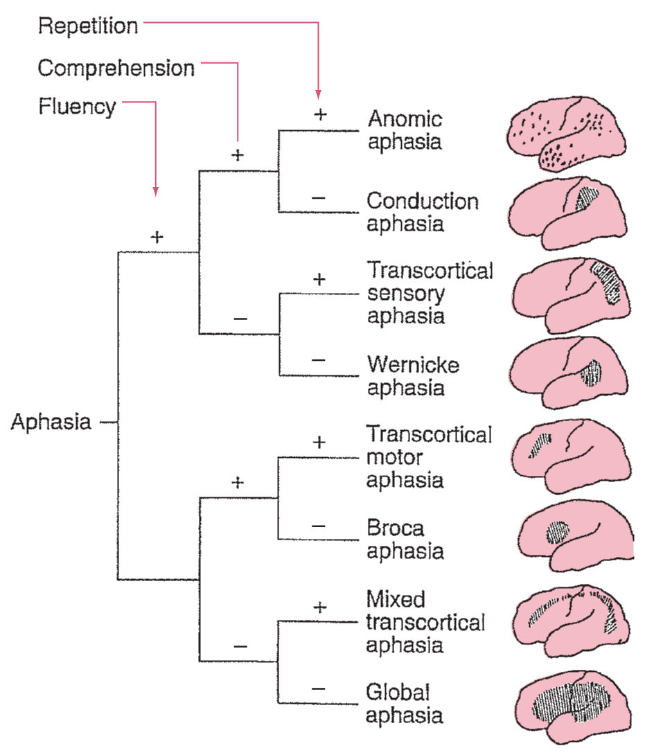 drsthanus's tweet image. Algorithm for diagnosis and localization of the eight classical cortical aphasias.

neupsykey.com/approach-to-th…