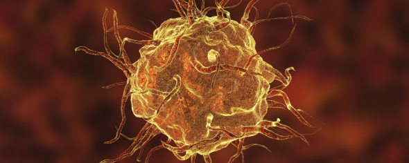 CD_AACR's tweet photo. RAF-independent MEK1-mutant Histiocytoses Respond to ERK Inhibition https://t.co/xaLr2ZmJoU
A #ResearchWatch summary of a recent study by Eli L. Diamond, Omar Abdel-Wahab, Benjamin H. Durham and colleagues. https://t.co/FdxdX4xdYH