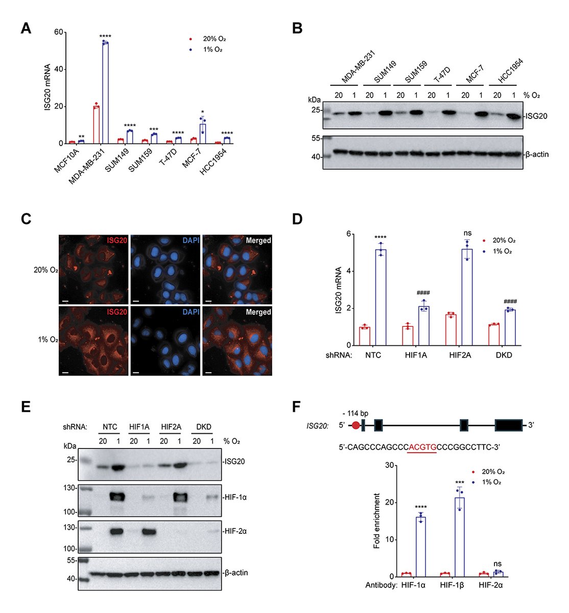 JExpMed's tweet image. Yongkang Yang, Gregg Semenza et al. show that, in response to intratumoral #hypoxia, #BreastCancer cells co-opt an antiviral mechanism to promote #cancer #StemCell specification and immune evasion, which are essential properties that enable #metastasis. hubs.la/Q03X_GWp0