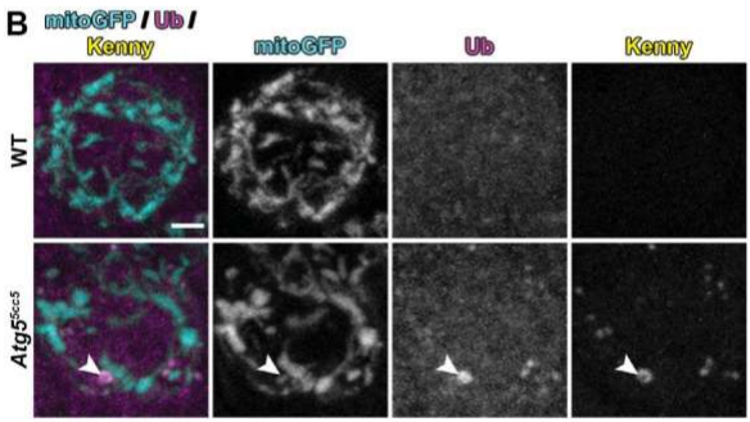 Wayne OVAS/Kresge Eye Institute/Wayne Health tweet media